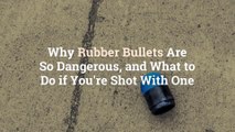 Why Rubber Bullets Are So Dangerous, and What to Do if You're Shot With One