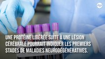 Ce biomarqueur détecte la maladie d'Alzheimer plus de 20 ans avant l'apparition des symptômes