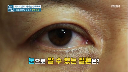 건강의 지표가 되는 OO, 눈으로 알 수 있다?