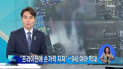[영상단독] "손가락 지져 지문 없애"…9세 여아 아동 학대
