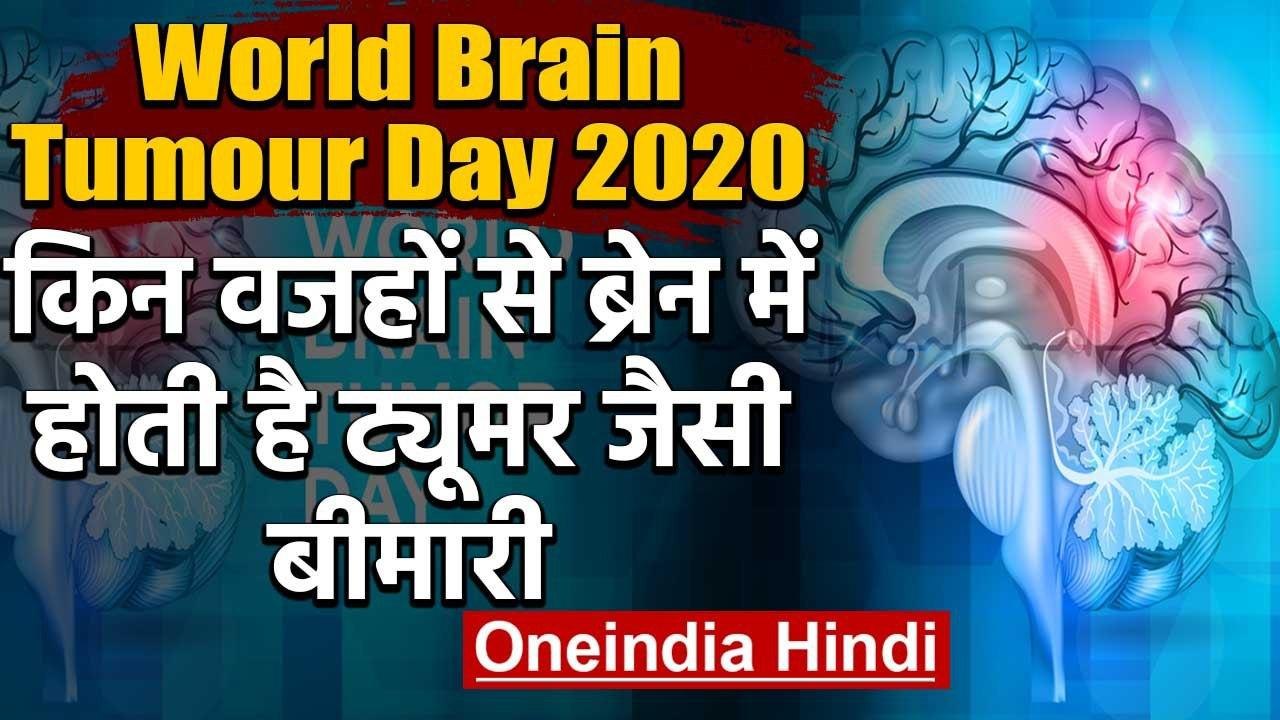 World Brain Tumour Day 2020: जानिए किन वजहों से...