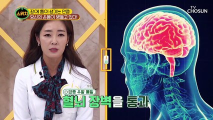 ‘장 누수 증후군’ 치매도 유발 ⊙⊙?!