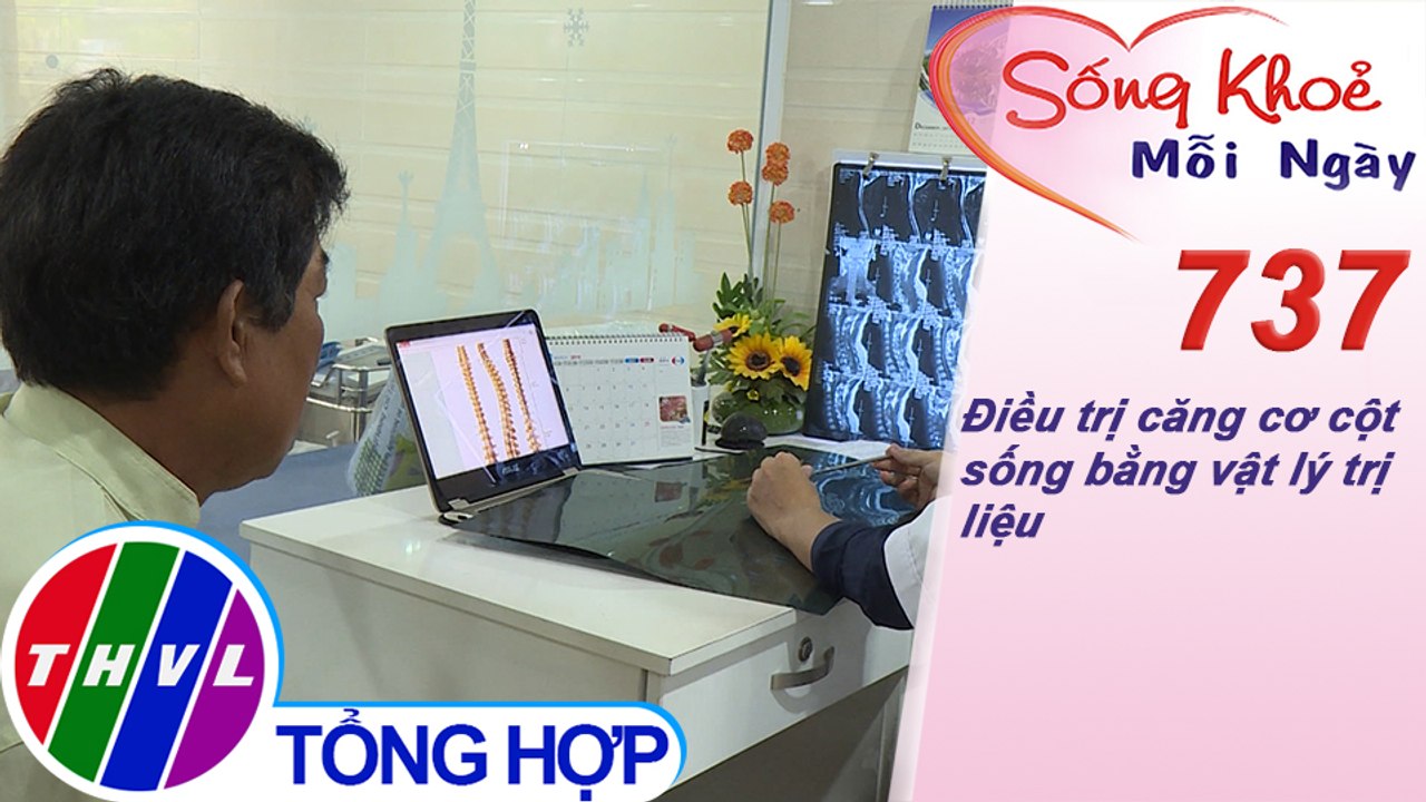 Điều trị căng cơ cột sống bằng vật lý trị liệu | Sống khỏe mỗi ngày - Kỳ 737