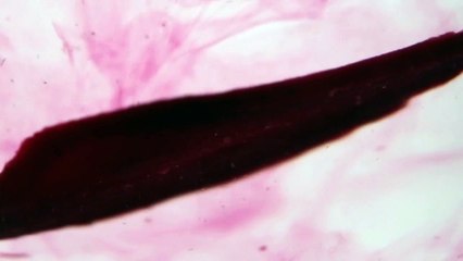 Die Seele der Wurst – Rote Beete