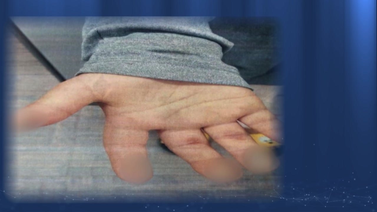 [앵커리포트] 코로나 장기화 속 아동 학대 신고 감소...? "사각지대 ↑" / YTN