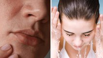 Sensitive Skin वाले लोग ऐसे रखें अपने Face का ख्याल | Sensitive Skin Care Tips | Boldsky