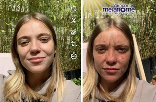 Un filtre Snapchat qui vous montre l'état de votre peau si vous aviez trop pris le soleil