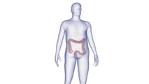 bd-hablamos-sobre-la-colitis-100620