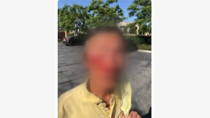 "미국서 한인 노인이 한국인이라고 무차별 폭행 당해" / YTN