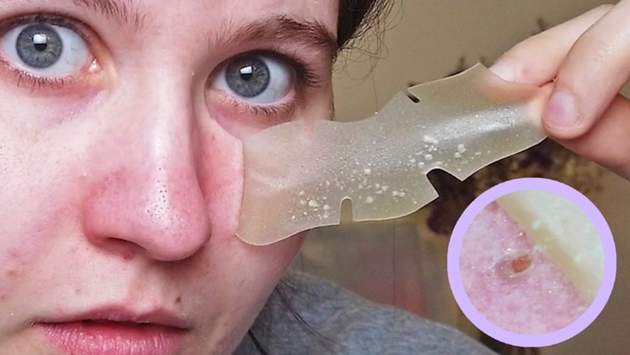 Overnight pore strips absorb excess sebum, gunk, and oil - video Dailymotion