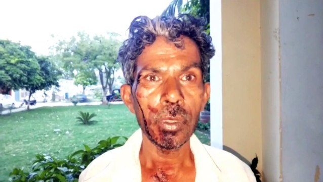 ग्राम नसीरपुर में दो पक्षों में हुई जमकर
