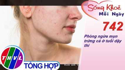 Phòng ngừa mụn trứng cá ở tuổi dậy thì | Sống khỏe mỗi ngày - Kỳ 742