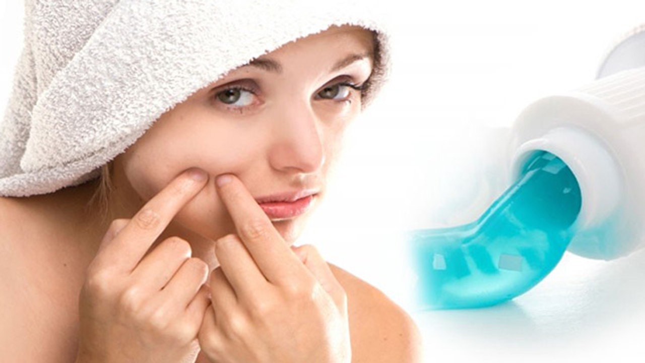 Toothpaste से मिलेंगे Skin को ये जबरदस्त फायदे । Skin Benefits Of Toothpaste । Boldsky