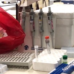 ลุ้นเฮวัคซีน'โควิด'ในลิง อีกความหวังโดย'คนไทย'