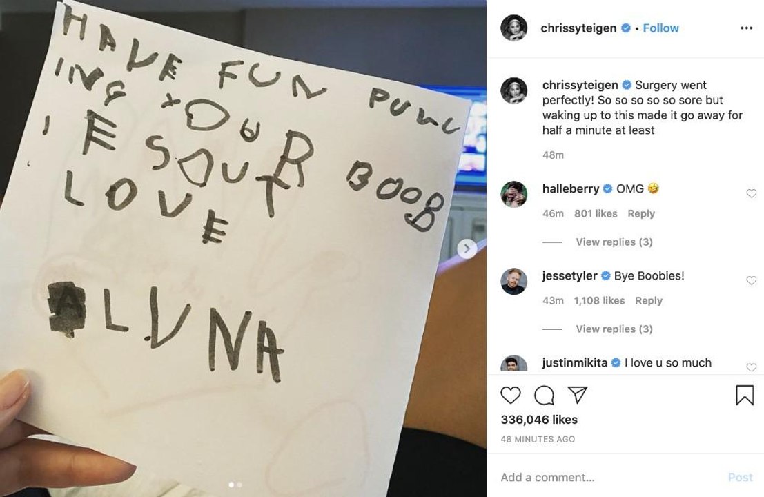 Chrissy Teigen lässt sich Brustimplantate entfernen