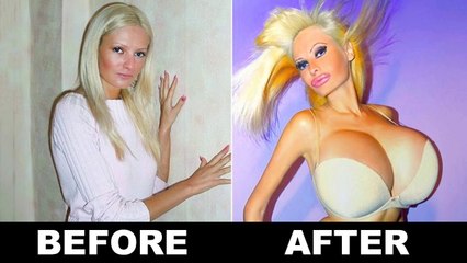 10 Extreme Plastic Surgery Transformations