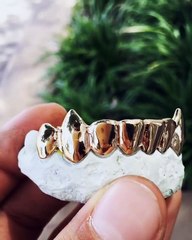10K Gold Grillz Teeth | 10K, 14K, 24K Gold Grillz | Laviticus