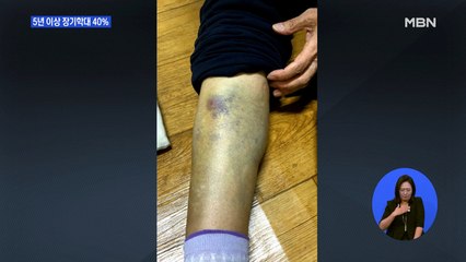 노인 학대, 5년 이상 장기가 40%…가해자는 가족이 대부분