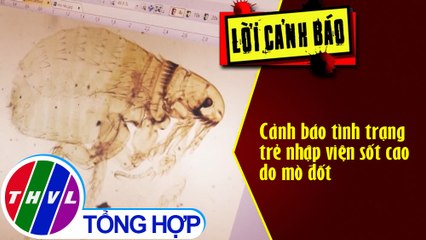 Cảnh báo tình trạng trẻ nhập viện sốt cao do mò đốt