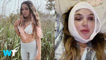 Fans REACT To Gabi Demartino Being Open And Honest About Her Plastic Surgery