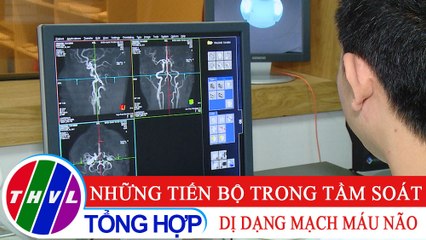 Sức khỏe của bạn: Những tiến bộ trong tầm soát dị dạng mạch máu não