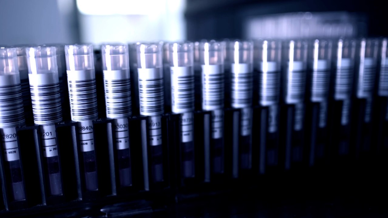 OMS cree que a finales de año estarán disponibles "millones de dosis" de vacunas