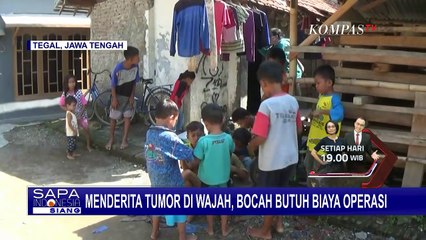 Bekerja Sebagai Nelayan, Orang Tua Kesulitan Biayai Pengobatan Tumor Sang Anak