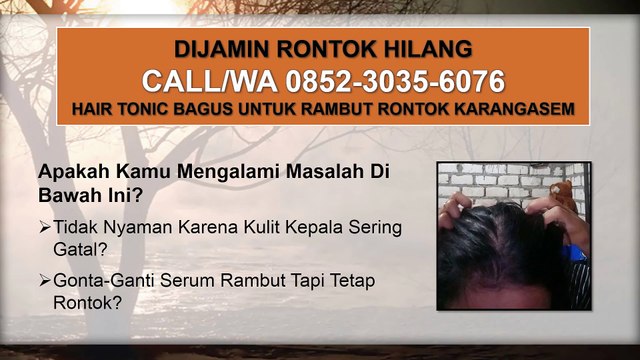 TERJAMIN CEPAT TUMBUH, CALL/WA 0852-3035-6076, Hair Tonic Essential Karangasem
