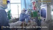 Inside ICU - Seven medics attend to one critically ill COVID 19 patient-