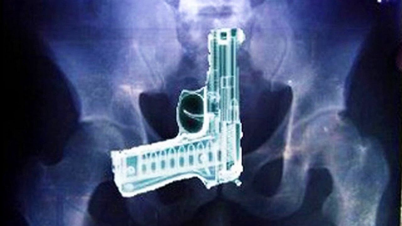 20 Strangest Things Found in Human Bodies
