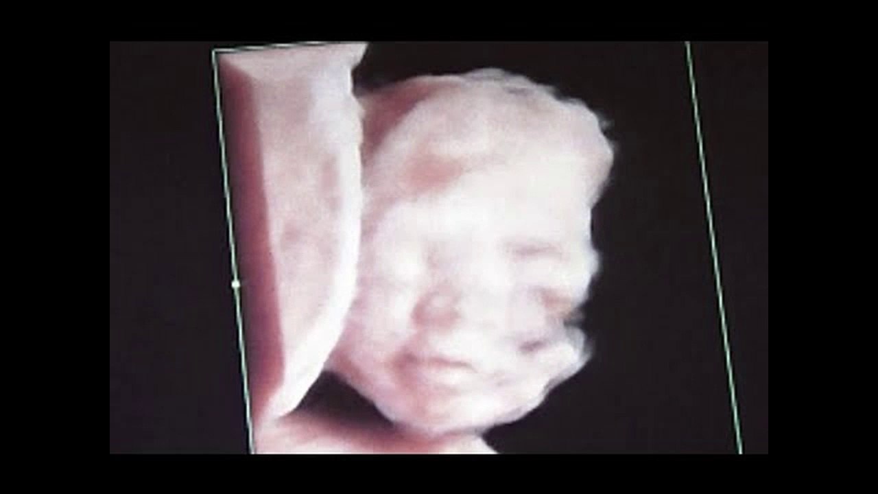 Weeks Old Fetus Smiling in mother's Womb - Ultrasound