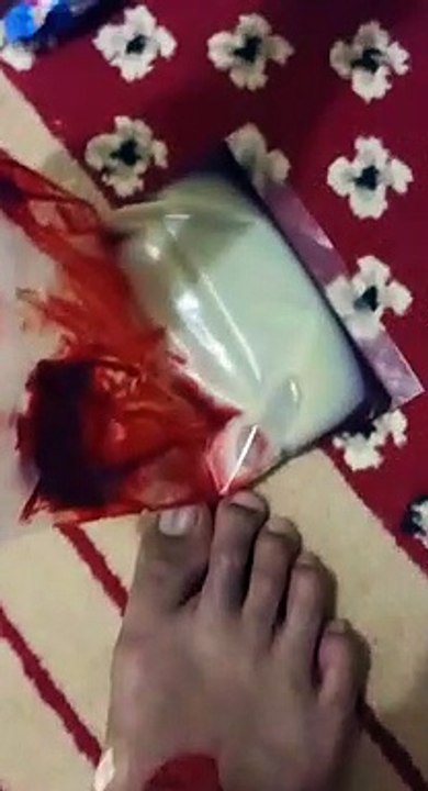 WA 0821-2636-0569, Terapi Al Fashdu Bandung Dago, Terapi Pashod Panggilan Di Cikutra Bandung