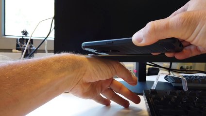 NFC Implant Boost for Enhanced Access