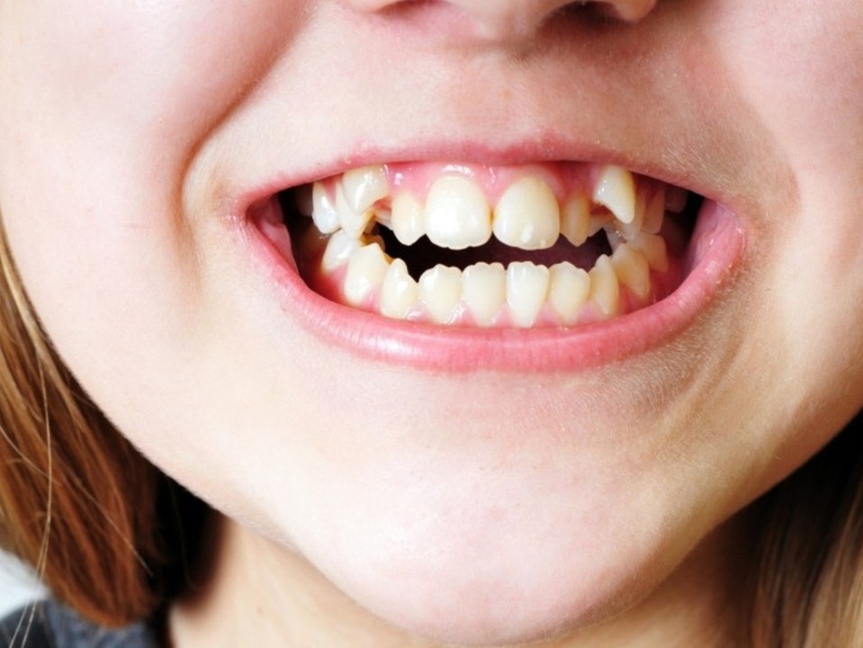 'Herr der Ringe'-Serie sucht Laiendarsteller mit 'flippigem Aussehen'