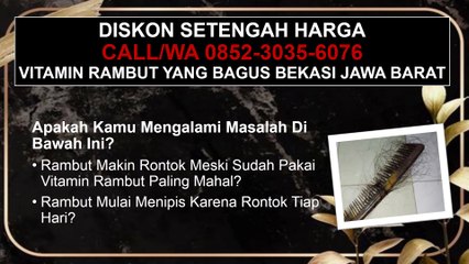 RAHASIA NYATA, CALL/WA 0852-3035-6076, Cara Mengatasi Rambut Rontok Bekasi Jawa Barat