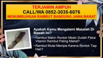TERJAMIN AMPUH, CALL/WA 0852-3035-6076, Menumbuhkan Rambut Bandung Jawa Barat