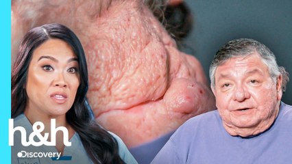 Hermanos sufren de raras lesiones en su piel | Dra. Sandra Lee: Especialista en piel | Discovery H&H