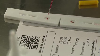 Brasil reacciona ante la pandemia aumentando el número de test entre la población