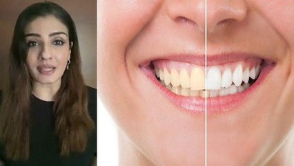 दांतो से पीलापन से दूर करने के लिए RaveenaTandon के Tips को करें Follow । Teeth Whitenting ।Boldsky