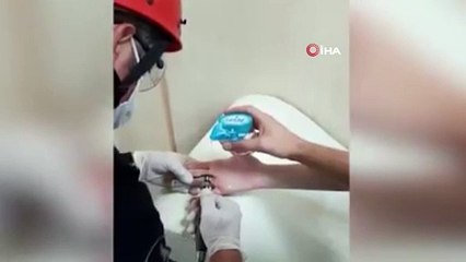 Parmağına sıkışan yüzüğü itfaiye ekipleri çıkardı