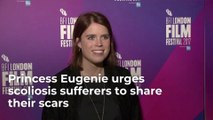 Princess Eugenie And Scoliosis