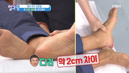 [변비 자가 진단법] ② 다리 길이를 확인해라