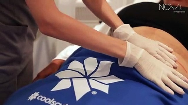 Coolsculpting Fat Removal in Dubai