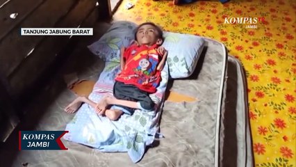 Bocah 9 Tahun Gizi Buruk Harapkan Bantuan