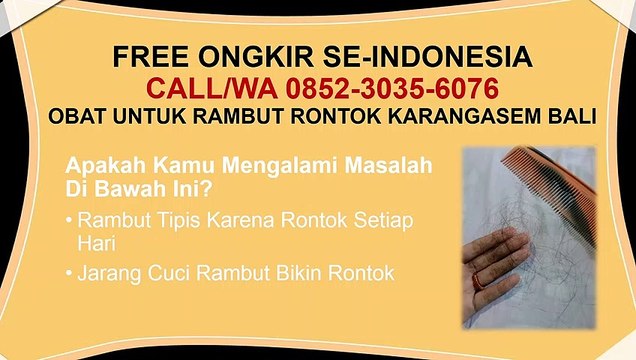 PALING LAKU DI 2020, CALL/WA 0852-3035-6076, Obat Penumbuh Rambut Karangasem Bali