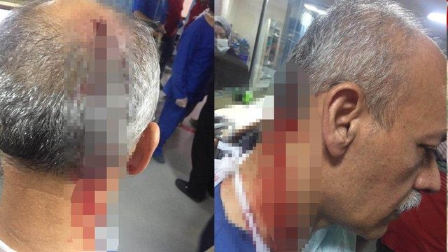 'Araba çarptı' diye ihbarda bulundu, hastanede doktora saldırdı