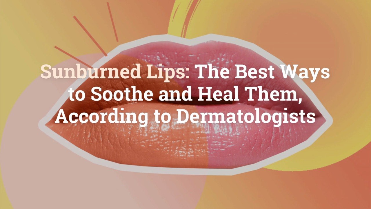 Sunburned Lips The Best Ways to Soothe and Heal Them, According to