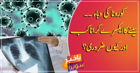 COVID-19: Seenay ka X-Ray Karana kab aur Kyun Zaroori hai?