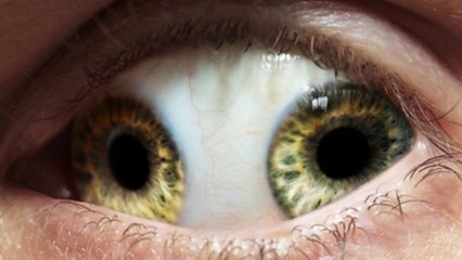 10 Strangest Medical Conditions