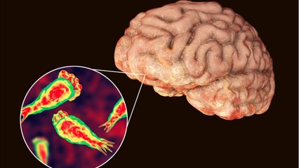 Brain-Eating Amoeba Shows Up In Florida